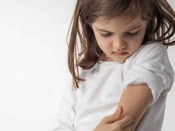 Managing Atopic Dermatitis in Youngsters