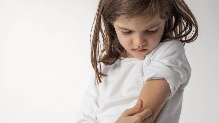 Managing Atopic Dermatitis in Youngsters