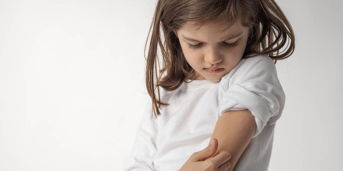 Managing Atopic Dermatitis in Youngsters