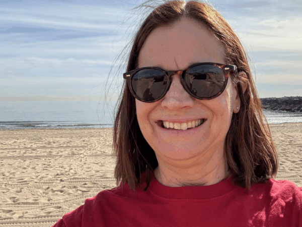 Descubrí que tenía osteoporosis cuando tuve fracturas en mis codos por una caída