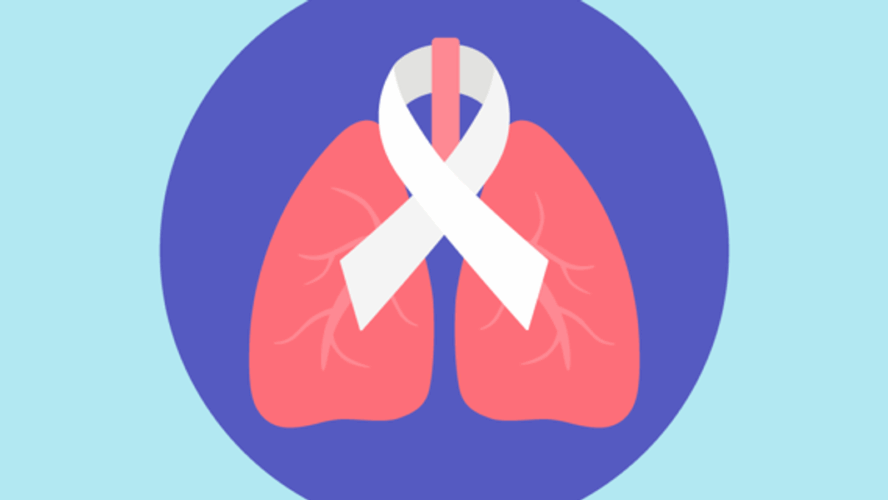 Síntomas de cáncer pulmonar