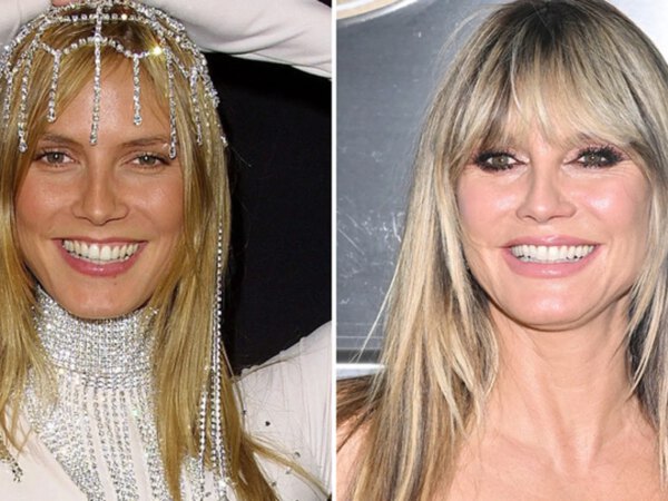 Heidi Klum — Good Genes or Good Docs?!