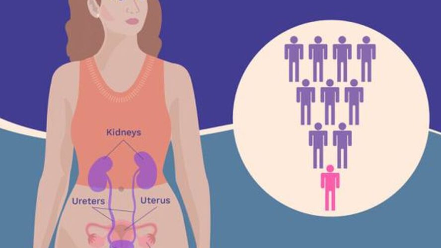 The Begin and Unfold of Urothelial Bladder Most cancers