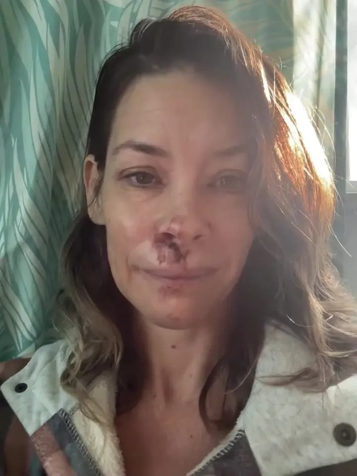 Evangeline Lilly Well being Replace: TBI Prognosis and Restoration