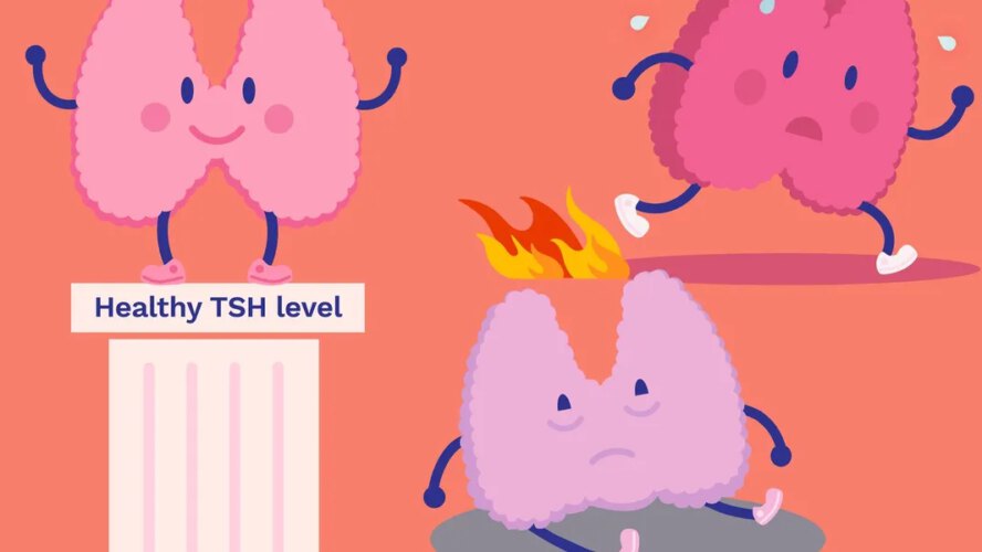 Thyroid Lab Outcomes – HealthyWomen