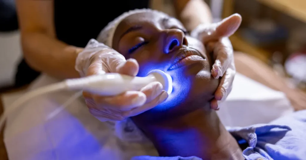 Laser skin resurfacing treatment