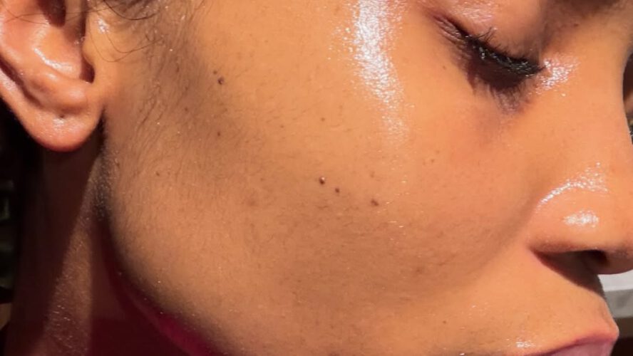 Pores and skin Barrier Magnificence: Why Defending Your Pores and skin Issues Most
