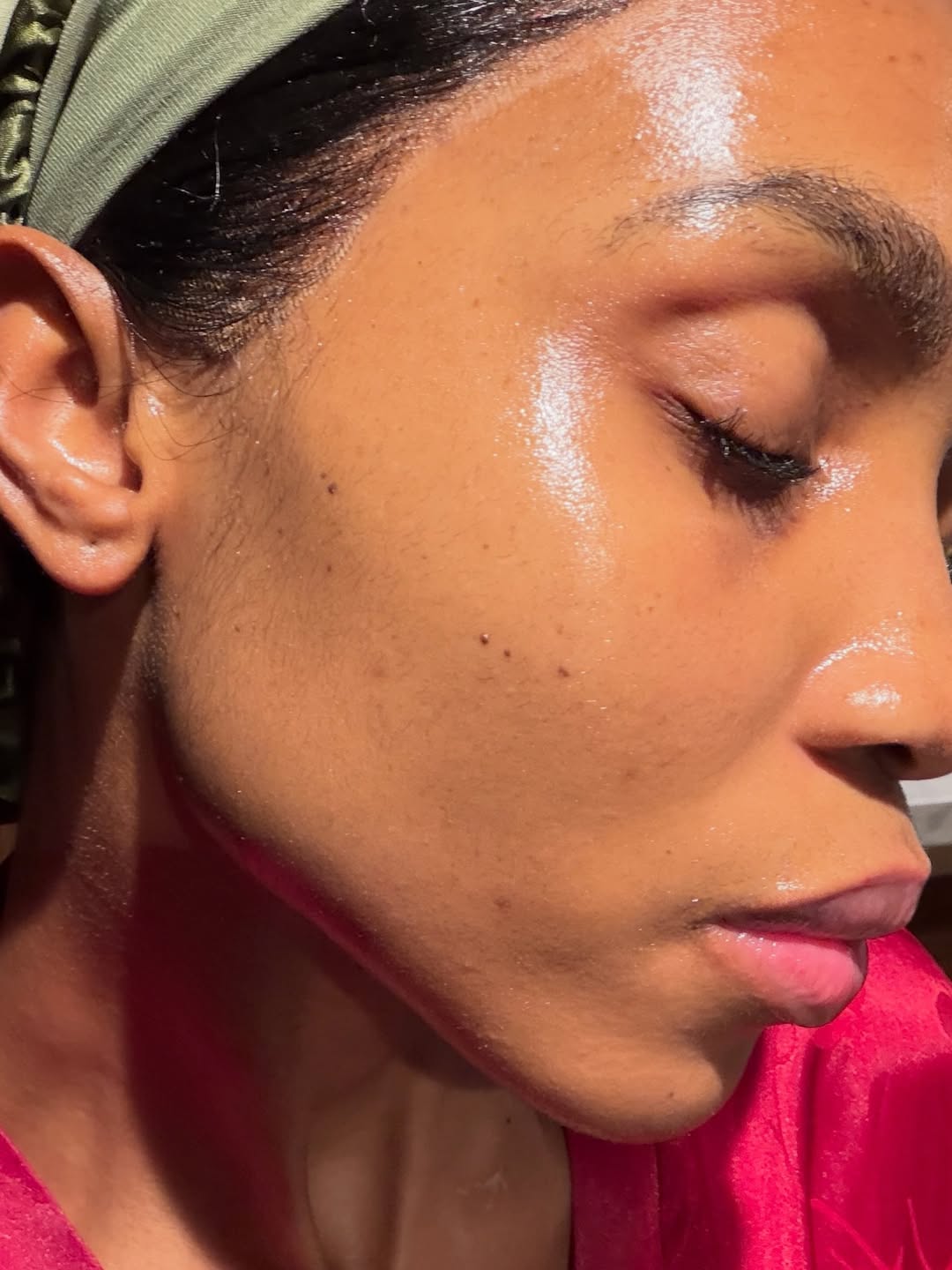 Pores and skin Barrier Magnificence: Why Defending Your Pores and skin Issues Most