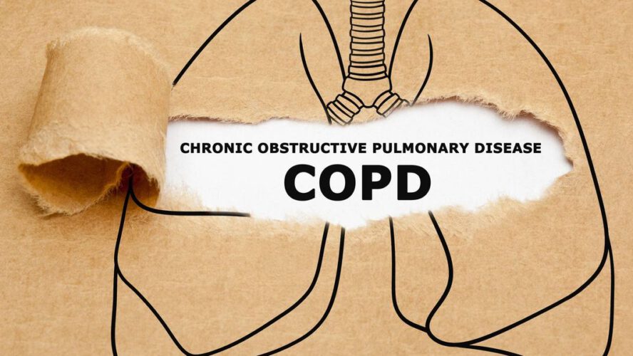 FAQs About COPD – HealthyWomen