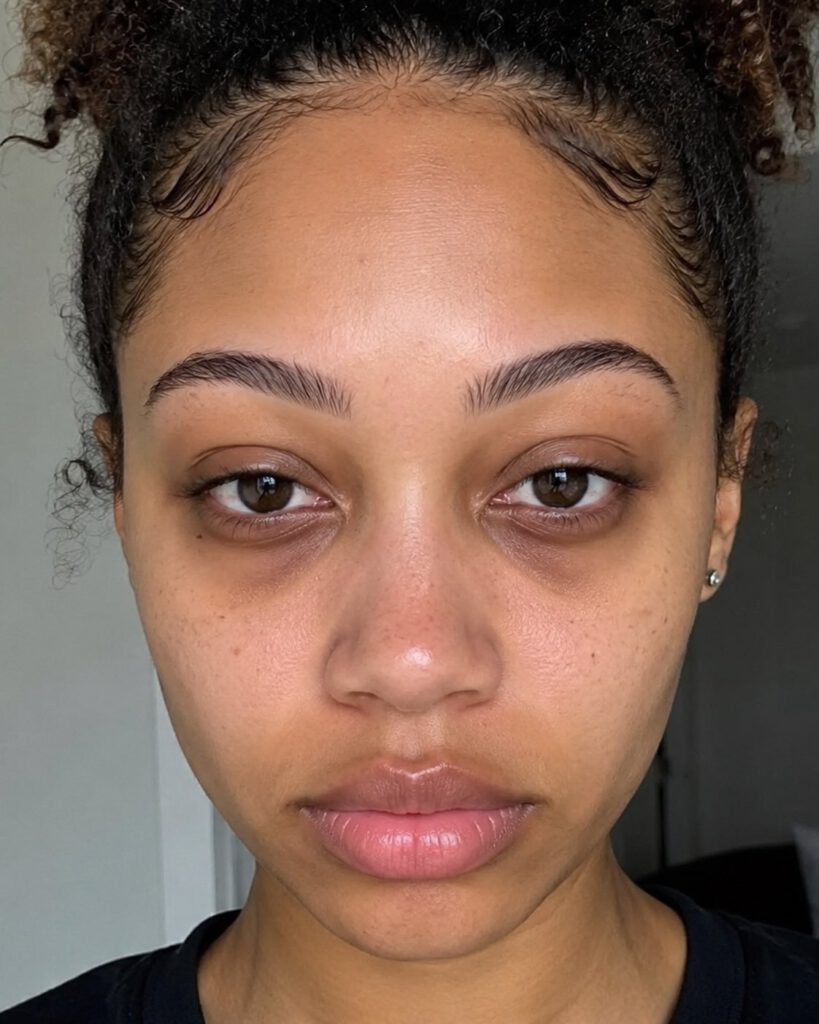 Under-Eye Creams for Dark Circles