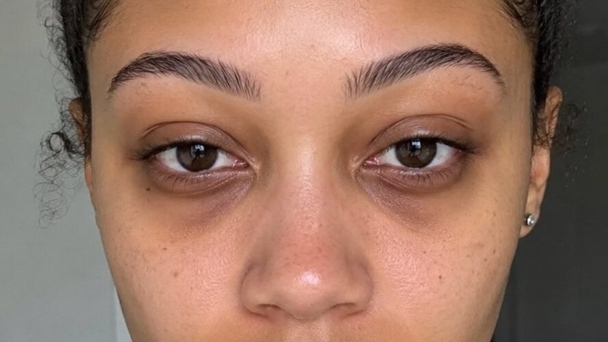 7 Beneath-Eye Lotions for Darkish Circles and Drained Eyes