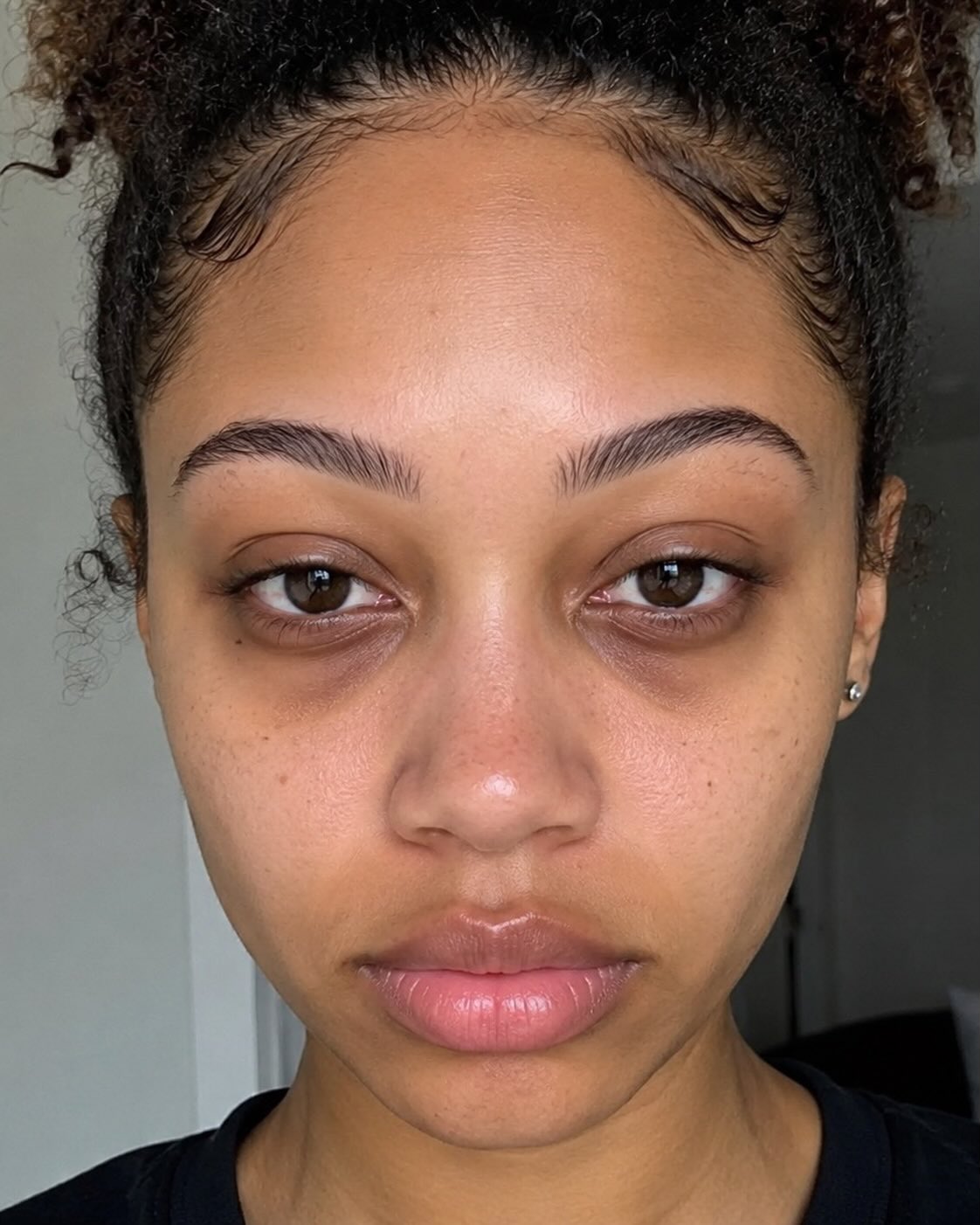 7 Beneath-Eye Lotions for Darkish Circles and Drained Eyes