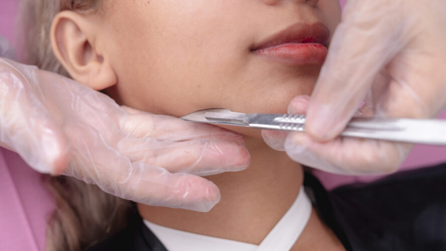 Is Dermaplaning Good for Your Face? Right here’s What to Know