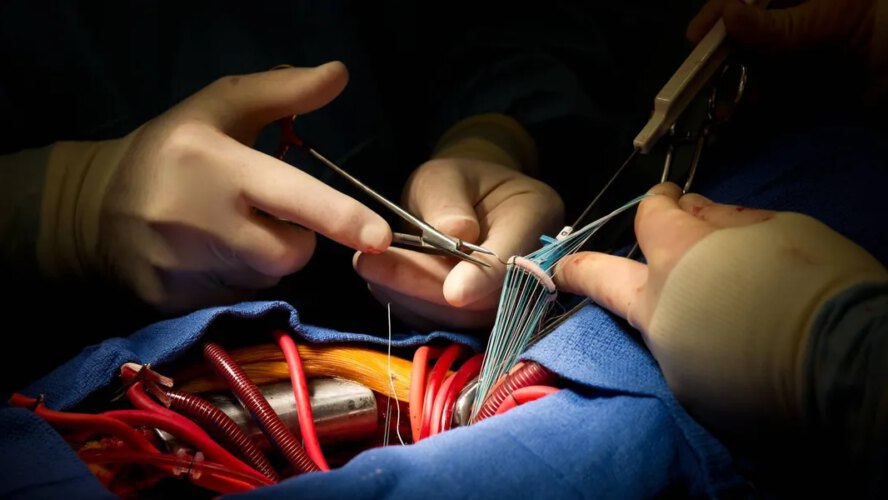 Coronary heart Valve Illness: Signs, Therapy and What Sufferers Ought to Know