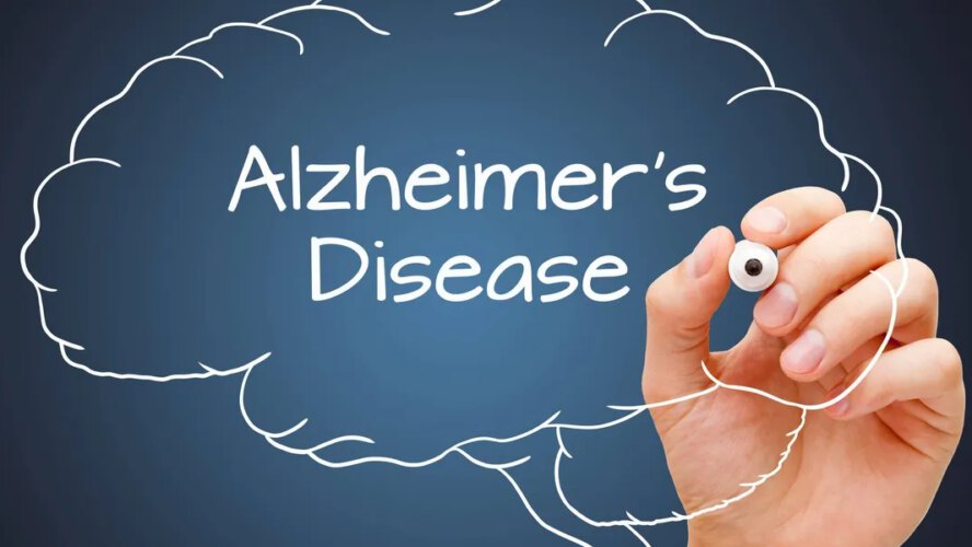 What Is Alzheimer’s Illness? – HealthyWomen