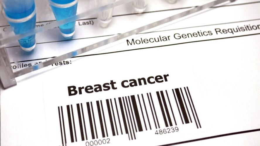 Information In regards to the Breast Most cancers Index Take a look at